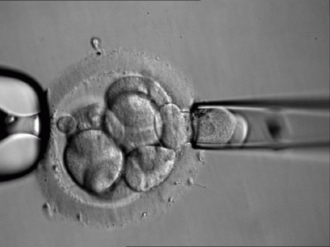 Предимплантационная генетическая диагностика эмбриона