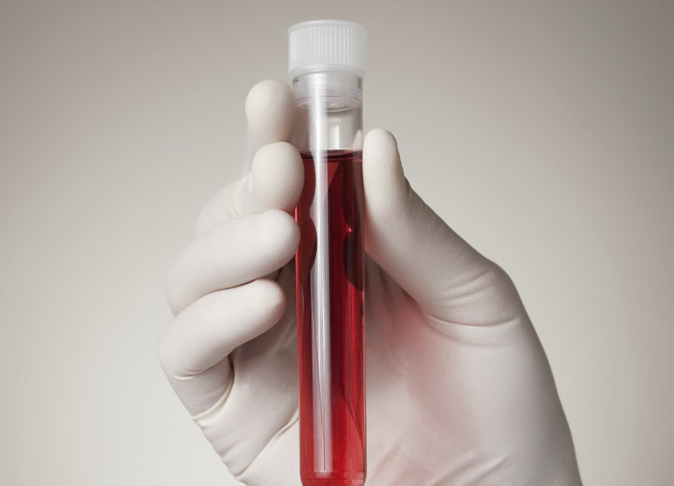 Анализ крови на сифилис RPR по доступной цене