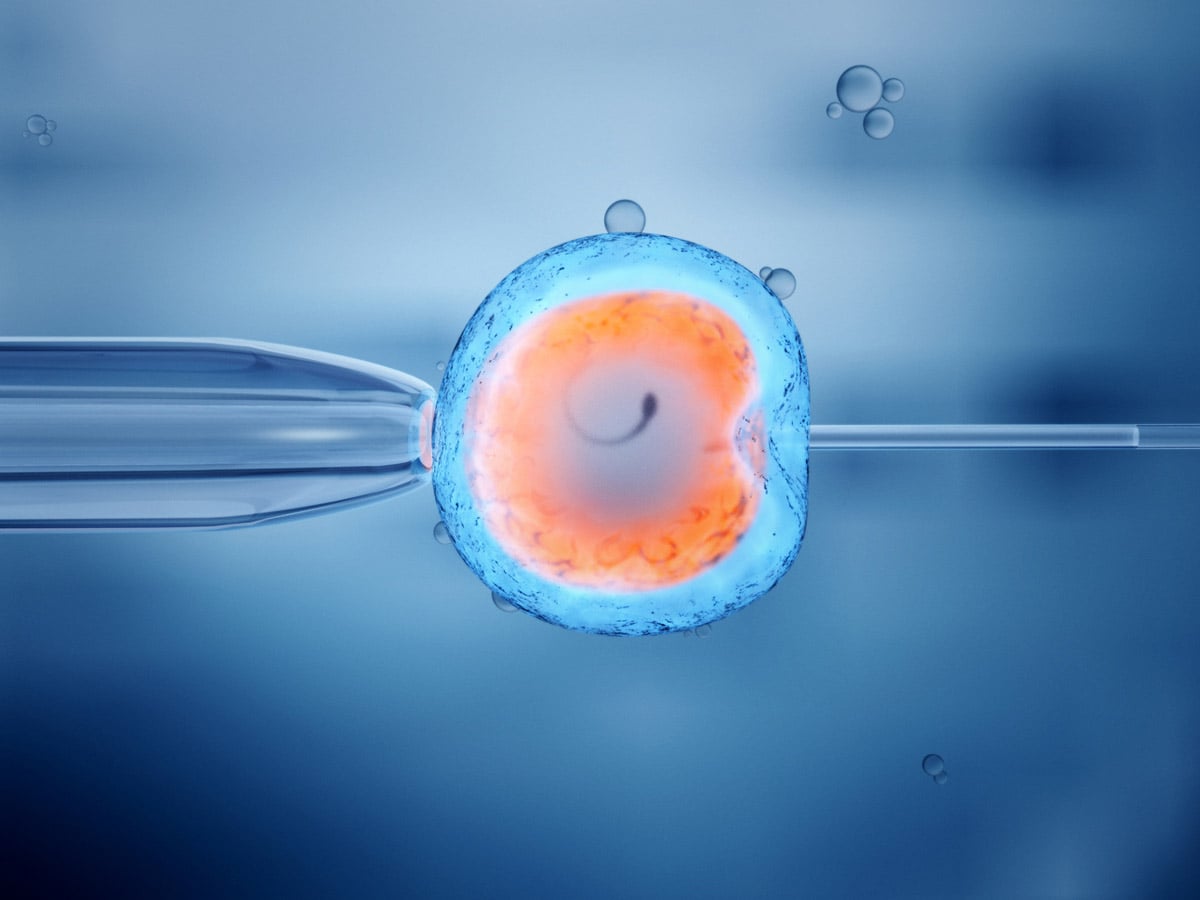 Извлечение сперматозоидов из яичка