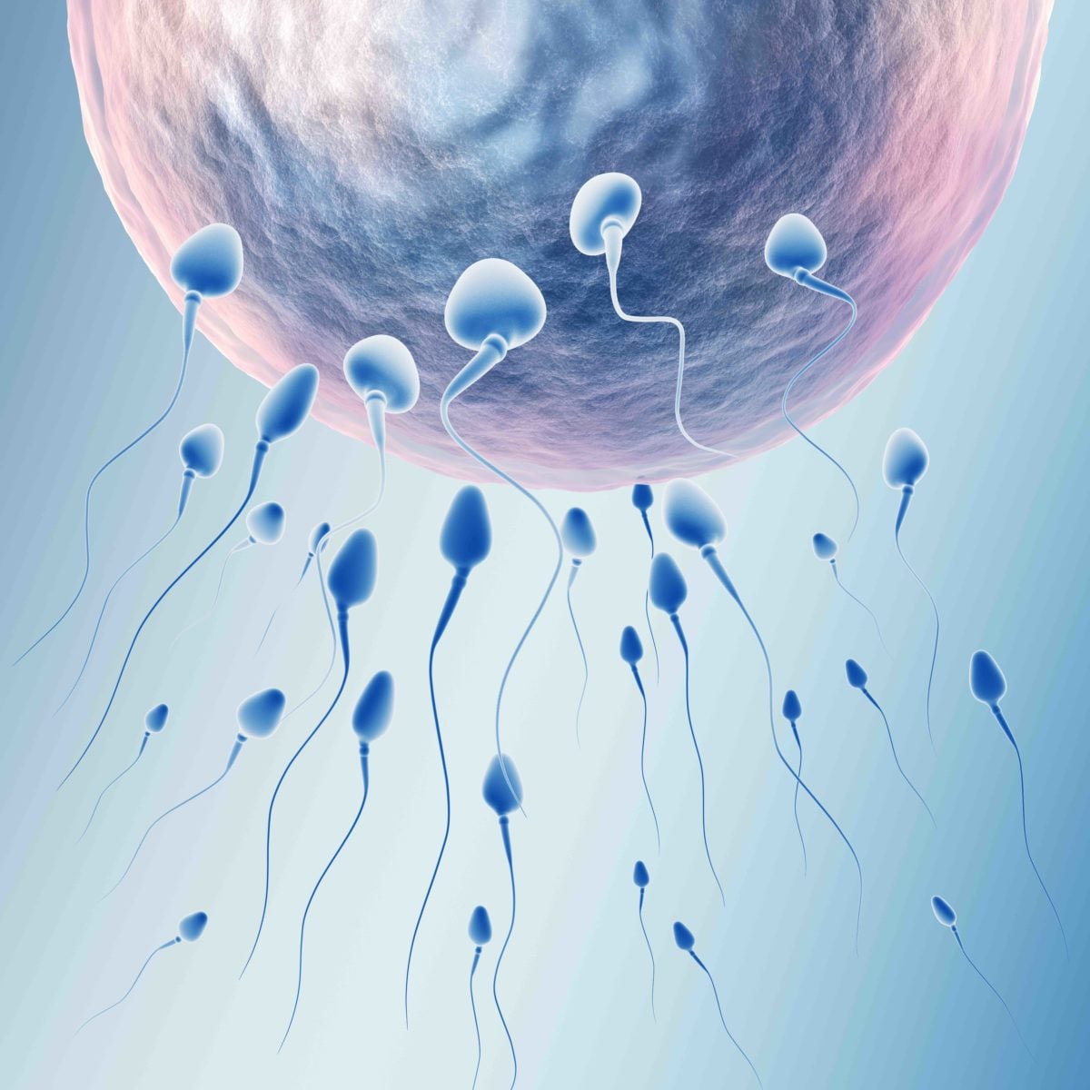 Патологии строения сперматозоидов