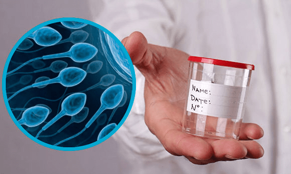 Спермограмма, сдать анализ спермы - цены в Москве в лаборатории ИНВИТРО